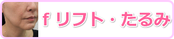 小顔リフト・糸スレッドリフト