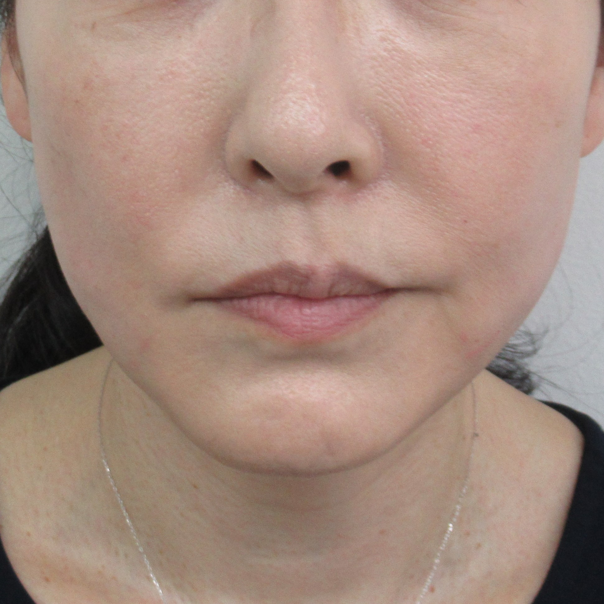 ショッピングリフト