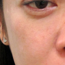 ゴルゴライン,写真