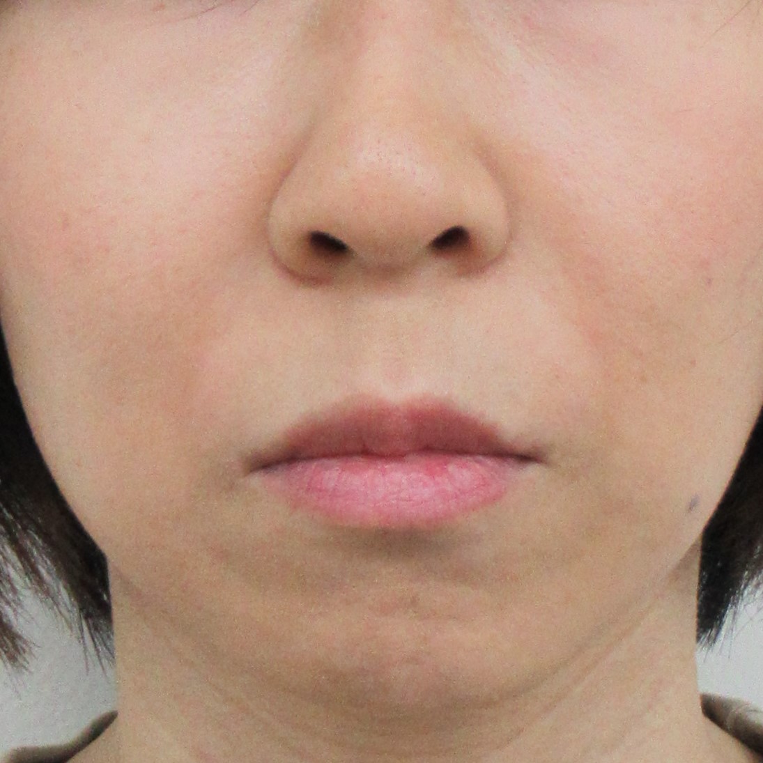 法令線,鼻唇溝,写真