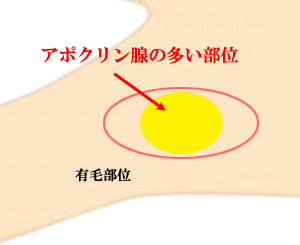 わきが保険手術