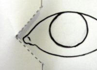 目頭切開,展開図